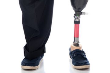 Orthopädietechnik Beinprothese